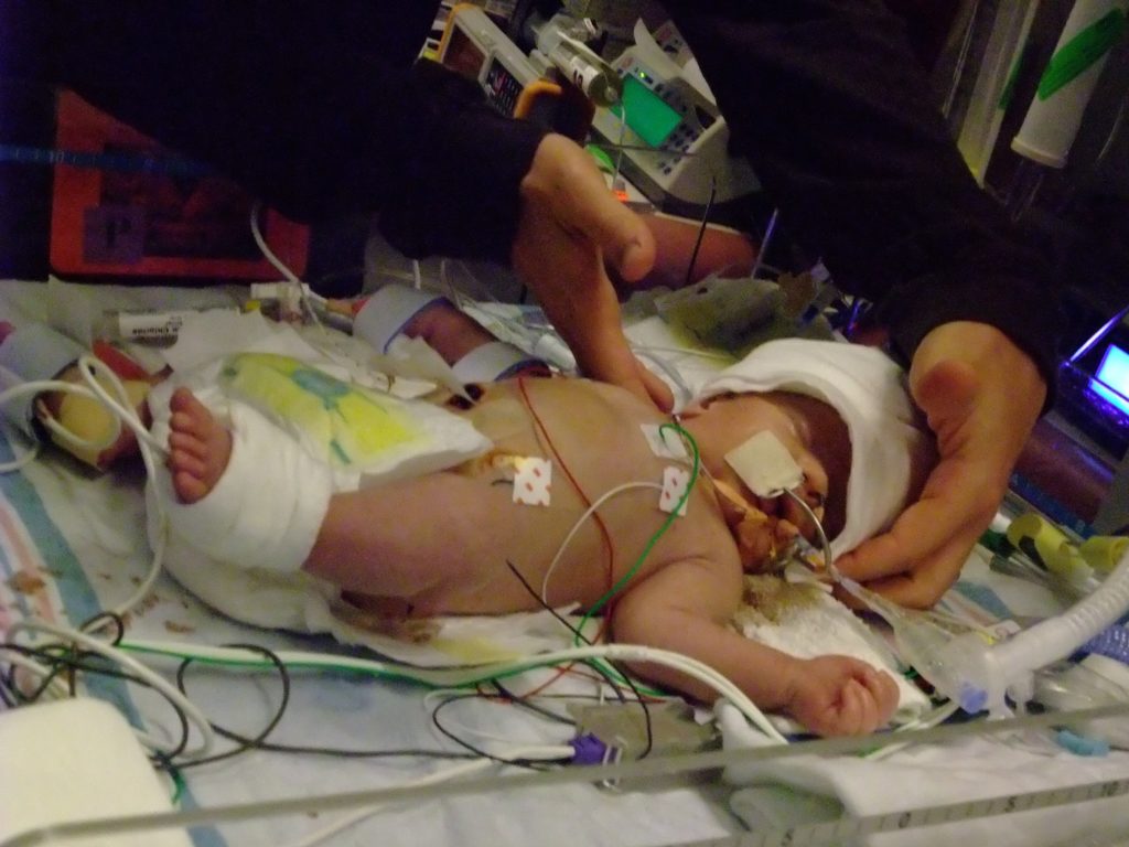 Birth Trauma — Oliver’s Story | PX Docs