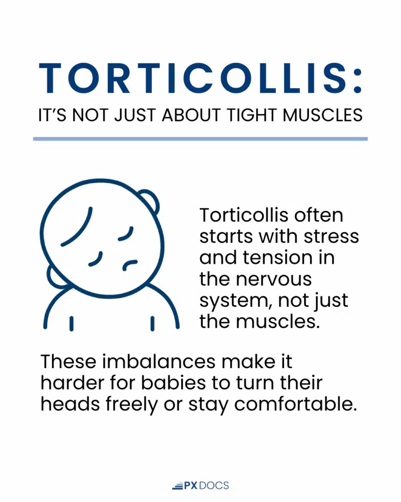 What Is Torticollis? | PX Docs