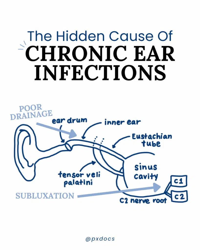 From Pain to Relief: Chronic Ear Infections in Children  | PX Docs