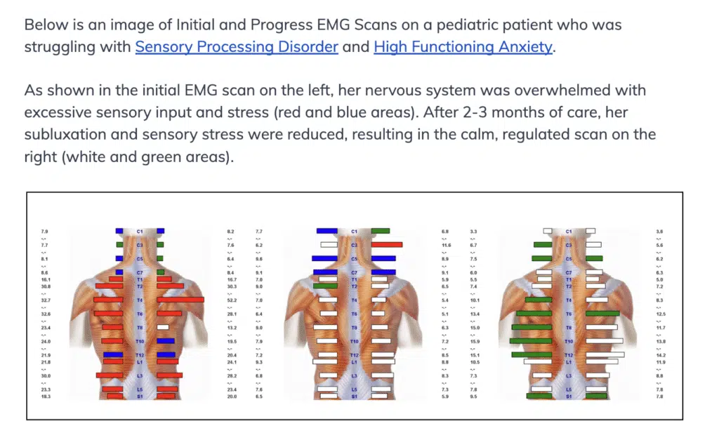What is Sensory Processing Disorder? | PX Docs