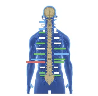 From Frequent Seizures and Declining Cognitive Function to Full Months of Being Seizure-Free and Better Focus | PX Docs