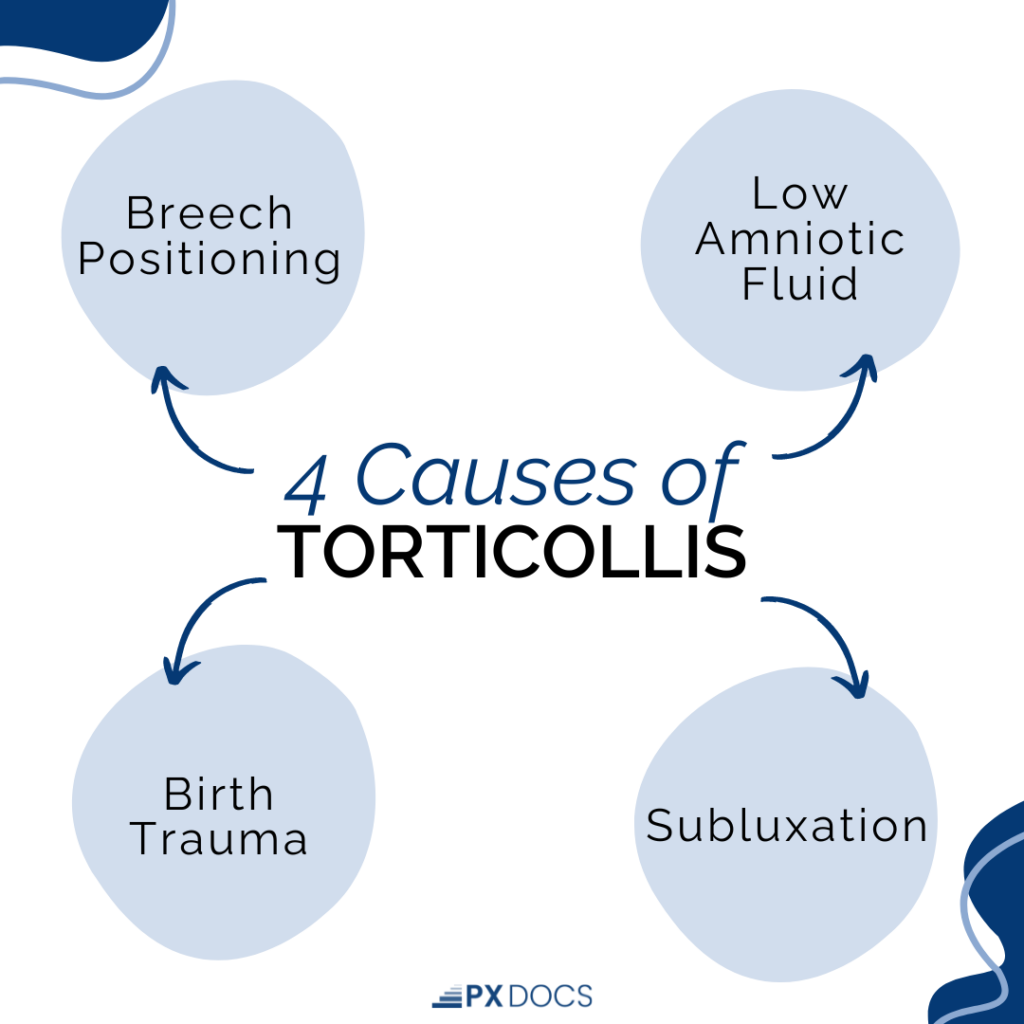 What Is Torticollis? | PX Docs