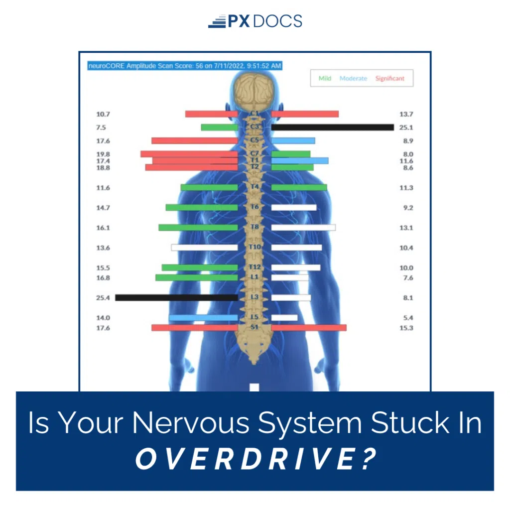 Finding Relief from an Overactive Nervous System | PX Docs