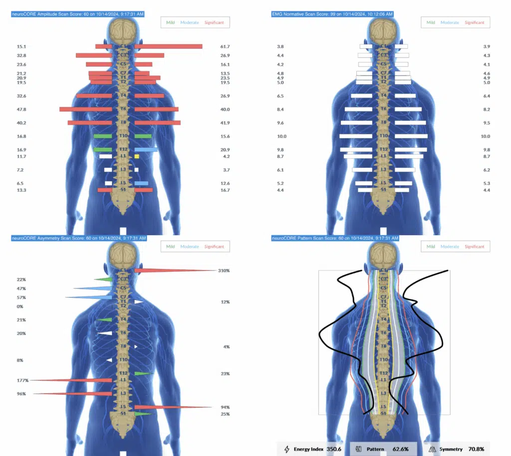 What is Level 2 Autism? Tantrums, Repetitive Behaviors, and More Signs | PX Docs