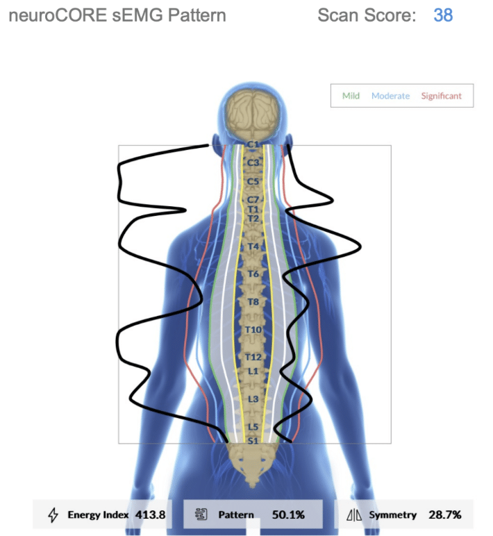 INSiGHT EMG Scans Unlock Your Child's Neurological Potential | PX Docs