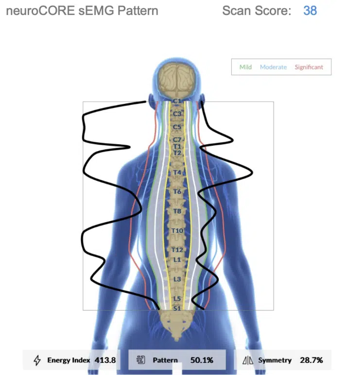 INSiGHT EMG Scans Unlock Your Child's Neurological Potential | PX Docs