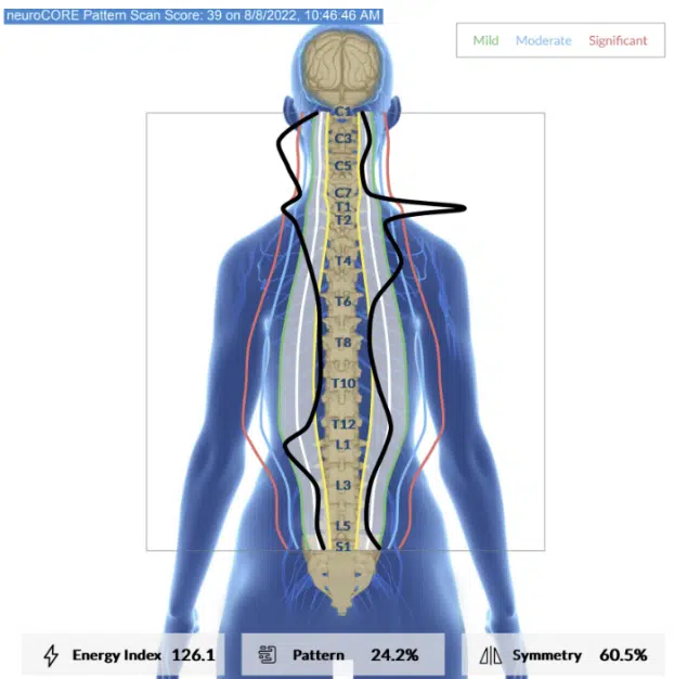 INSiGHT EMG Scans Unlock Your Child's Neurological Potential | PX Docs