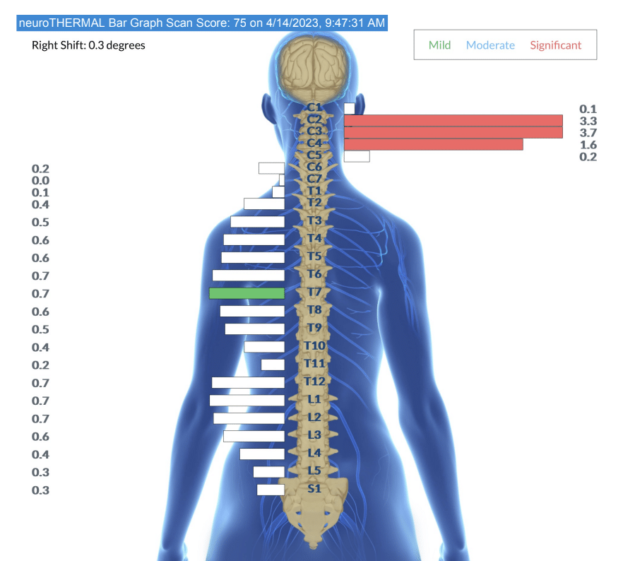 What Causes A Rash from Antibiotics? | PX Docs