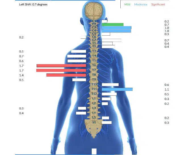 From Unrelenting Heartburn and Sciatic Pain to Minimal Symptoms and Feeling Great | PX Docs