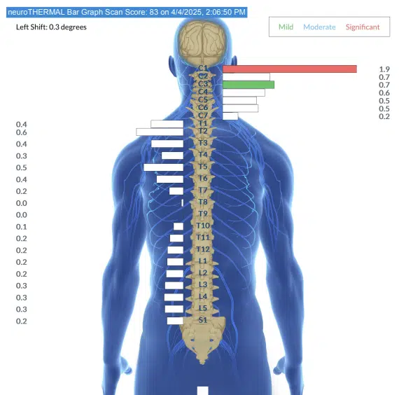 From Sleep Struggles, Flat Spots and Endless Fussiness to Major Improvements in Every Area | PX Docs