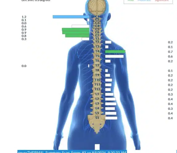 The 3 Hidden Roadblocks Slowing Your Child’s Neurological Healing | PX Docs