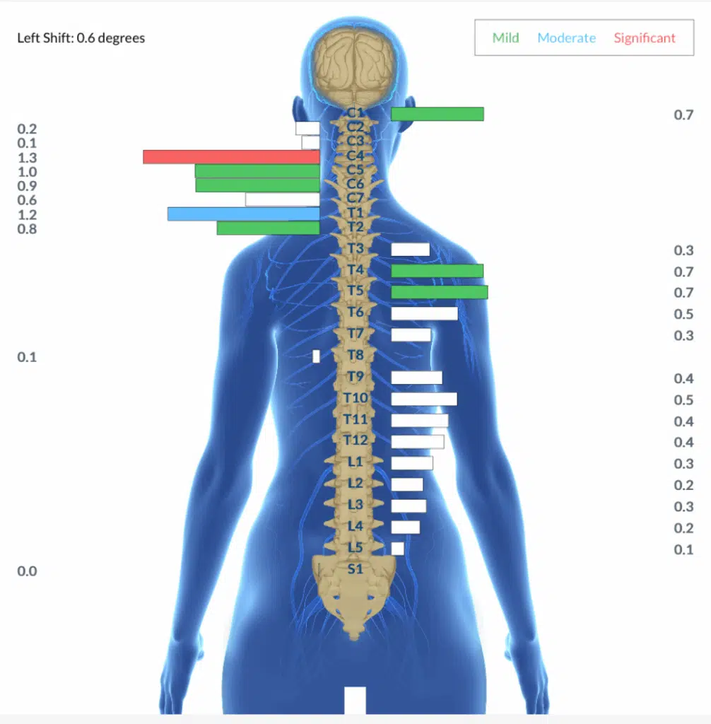Understanding PANS/PANDAS in Children | PX Docs