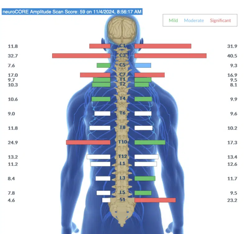 Exploring the Root Cause of Sensory Seeking Autism | PX Docs