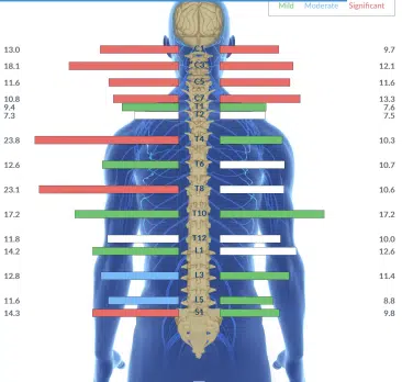 From Torticollis, Asymertical Movement and Waking Up 8+ Times a Night in Distress to Graduating PT and Sleeping Well | PX Docs