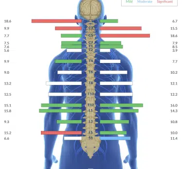 From Torticollis, Asymertical Movement and Waking Up 8+ Times a Night in Distress to Graduating PT and Sleeping Well | PX Docs