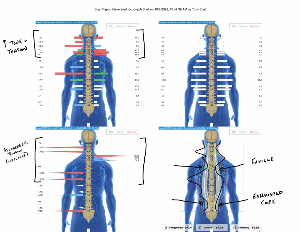 Understanding and Addressing Motor Planning Difficulties | PX Docs