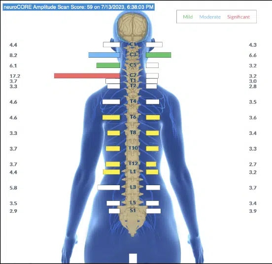 How Stress During Pregnancy Impacts Infant Development | PX Docs