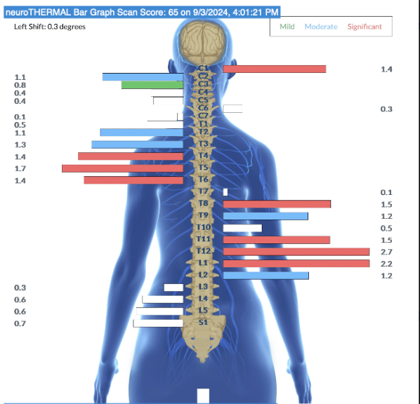 How Stress During Pregnancy Impacts Infant Development | PX Docs
