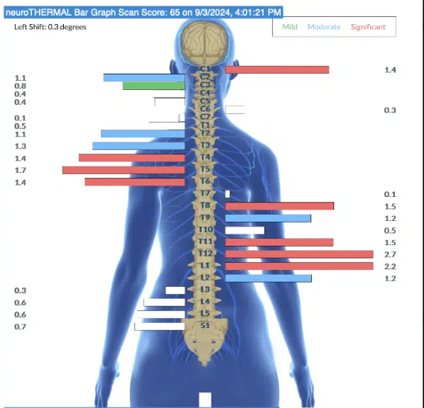 How Stress During Pregnancy Impacts Infant Development | PX Docs