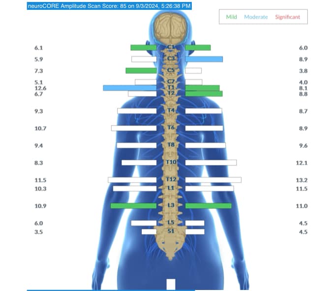 Subluxation in Stressed Adults: Why Your Body Can't Turn Off Fight-or-Flight Mode | PX Docs