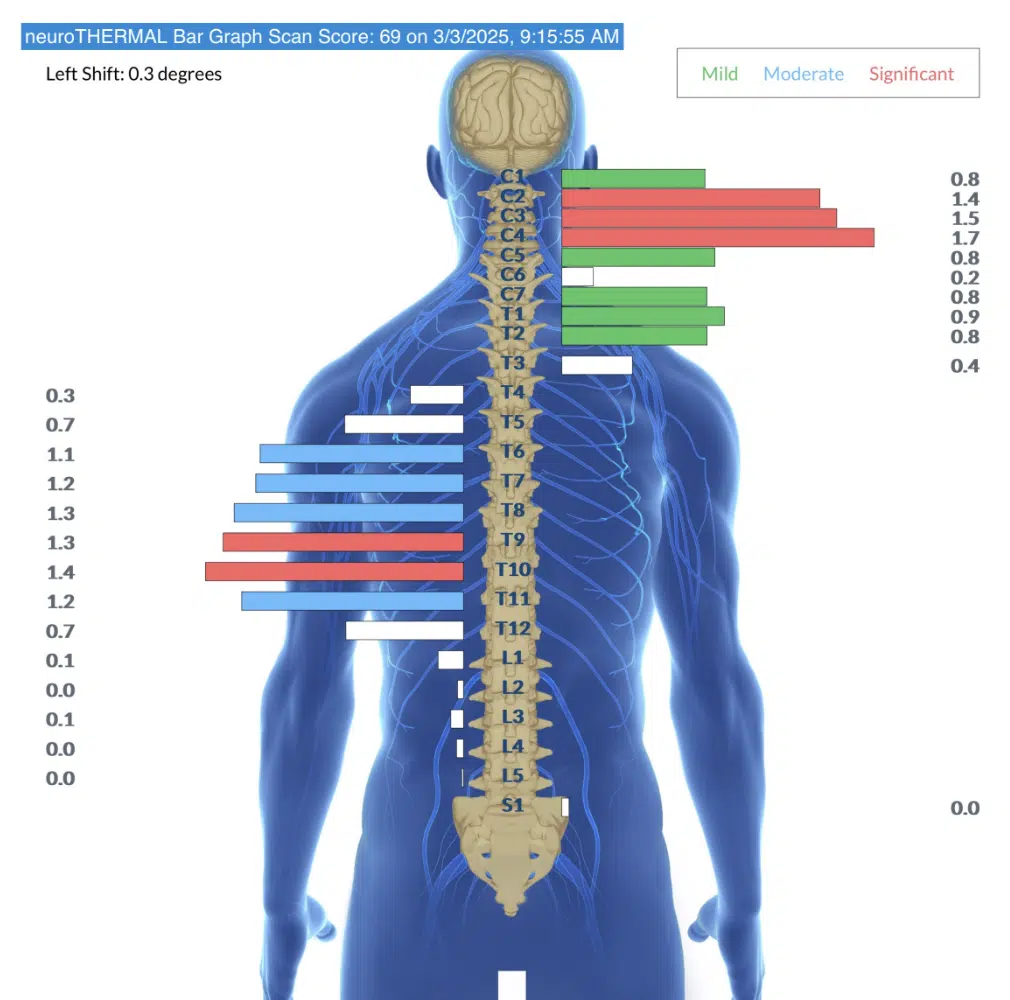 Forget Blood Work! In 10 Minutes Your Nervous System Will Tell You Answers | PX Docs
