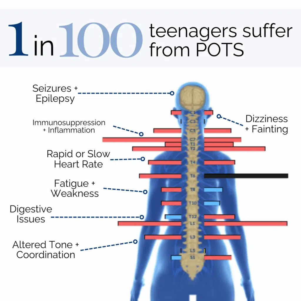 What Causes POTS Syndrome in Children? | PX Docs