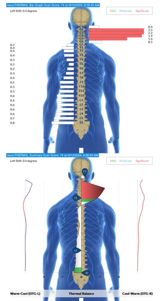 Tongue Tied and Lip Tied: Understanding Feeding Struggles and What Your Baby Really Needs | PX Docs