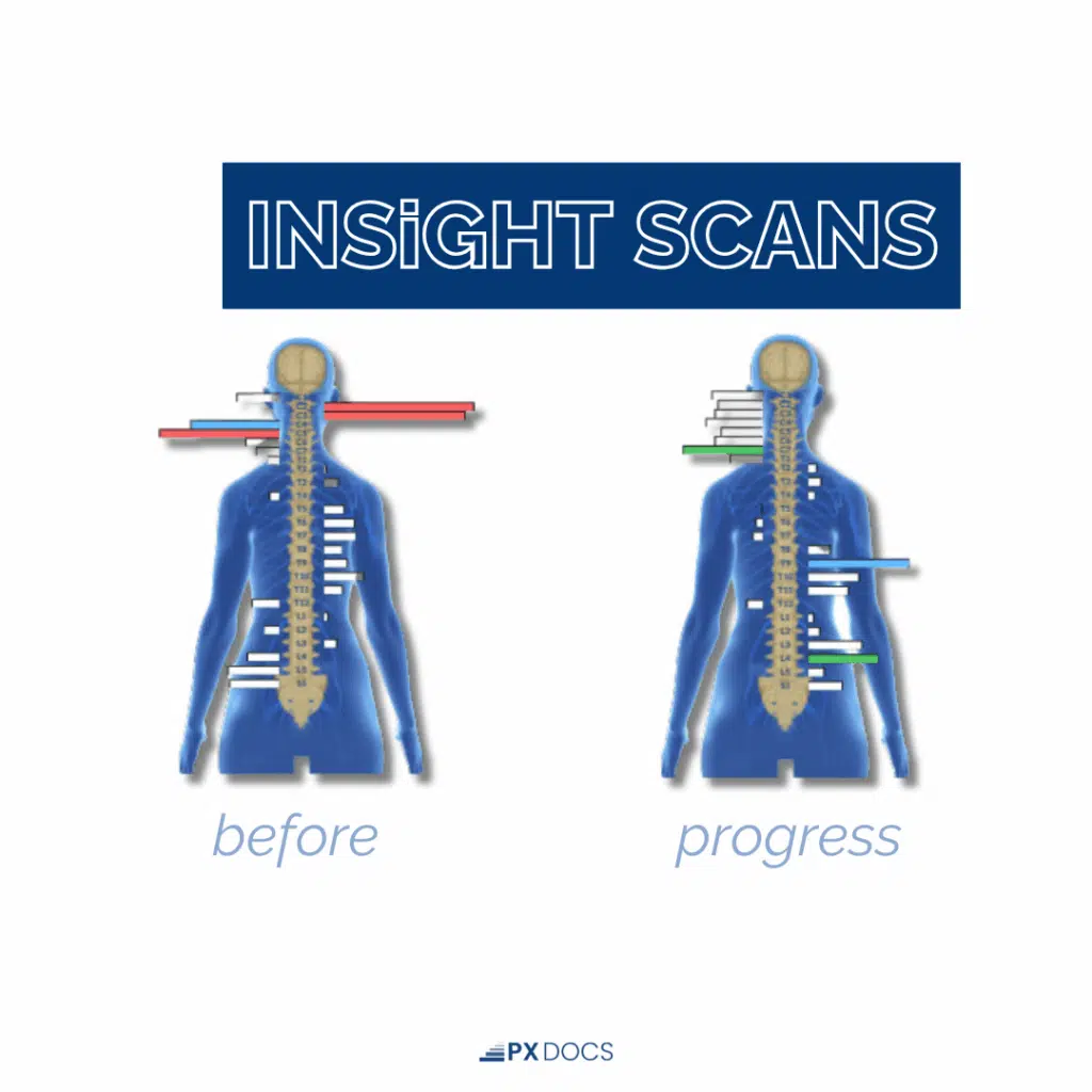 Navigating the Challenges of Dysautonomia POTS in Children | PX Docs