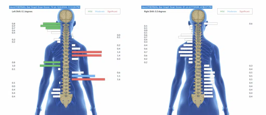 From Weekly Pain and Lifelong Anxiety to Confident, Calm and a Happier Mama | PX Docs