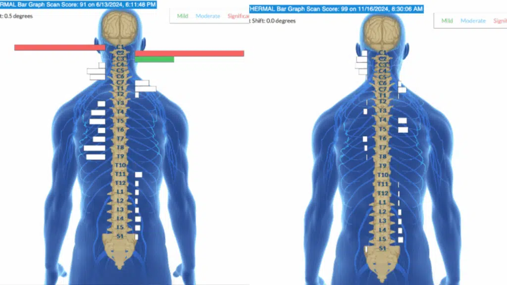 Understanding Your Child's Development with Examples of Gross Motor Skills | PX Docs