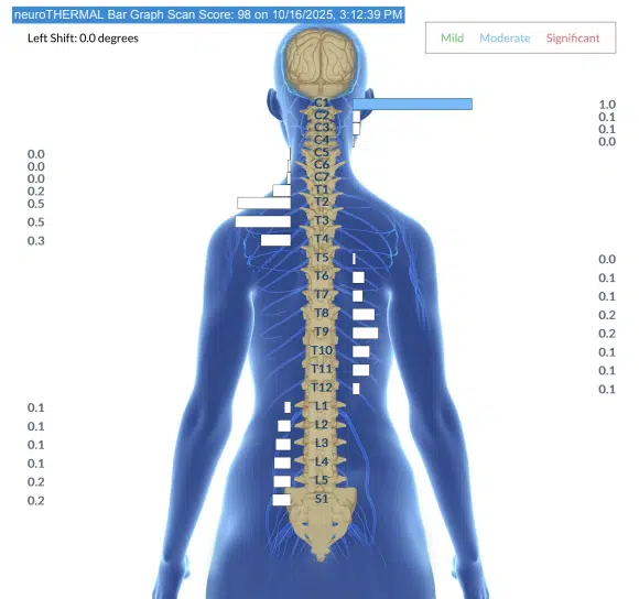 From Multiple Daily Seizures to Celebrating Seizure Free Days | PX Docs