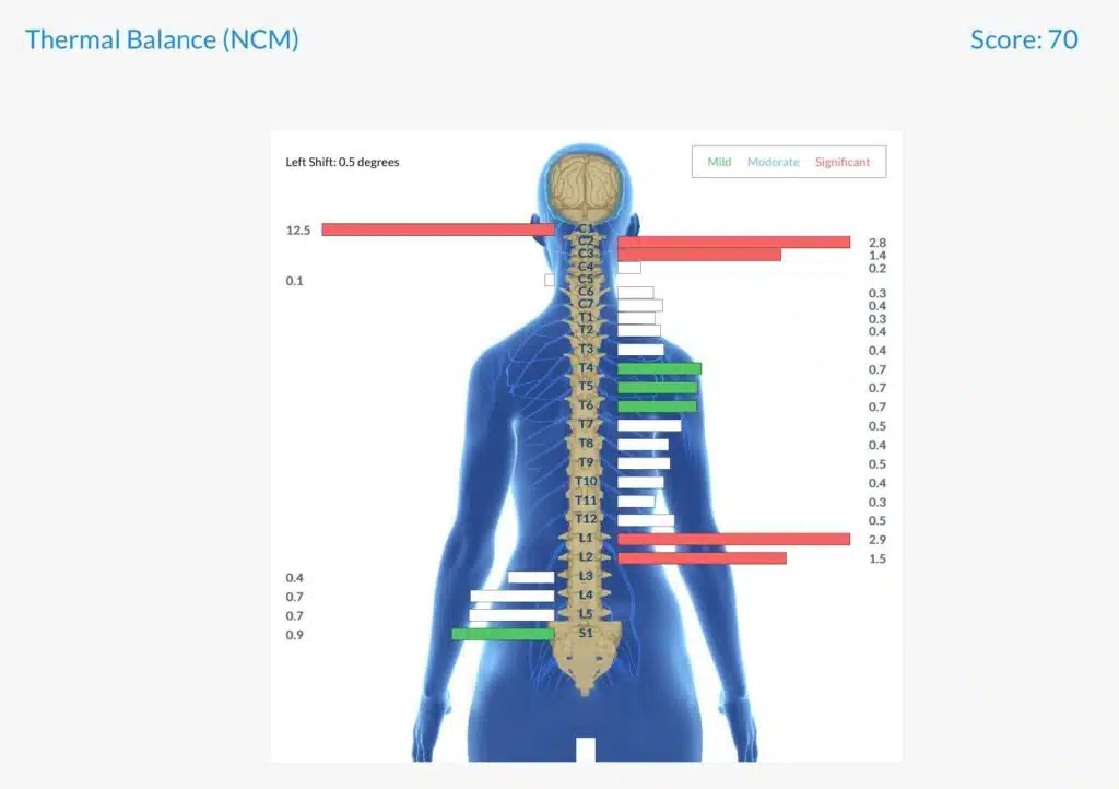 From Speech Challenges, Frequent Tantrums and Sensory Issues to Finding her Voice, Calm and Confidence | PX Docs