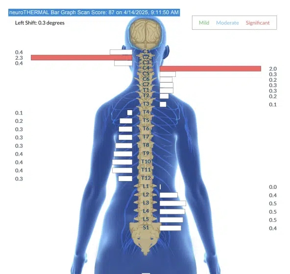From Multiple Daily Seizures to Celebrating Seizure Free Days | PX Docs