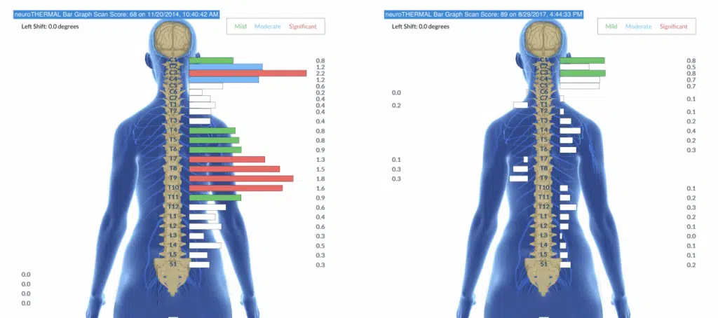 From Autism and Sensory Challenges to Academic Honors, Independence, and a Great Job | PX Docs