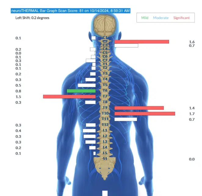Mold Toxicity in Children | PX Docs