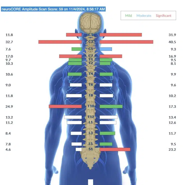 Why ADHD in Women Goes Undiagnosed for Decades | PX Docs