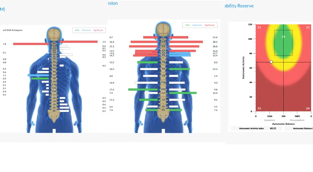Autism Test for Teens: Understanding Late Diagnosis and What Parents Need to Know | PX Docs