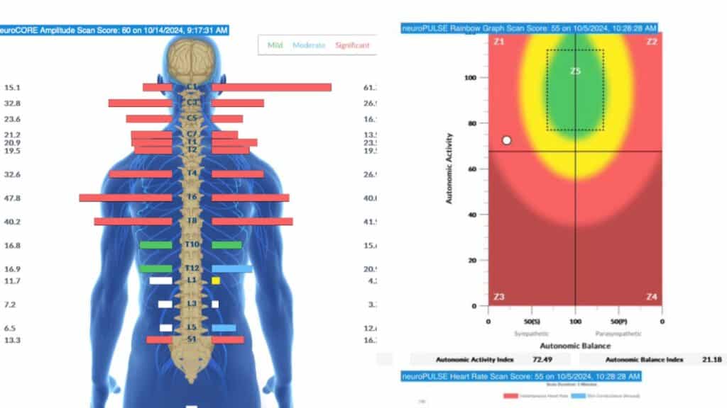 Sensory Seeking in Children: The Hidden Neurological Cause | PX Docs