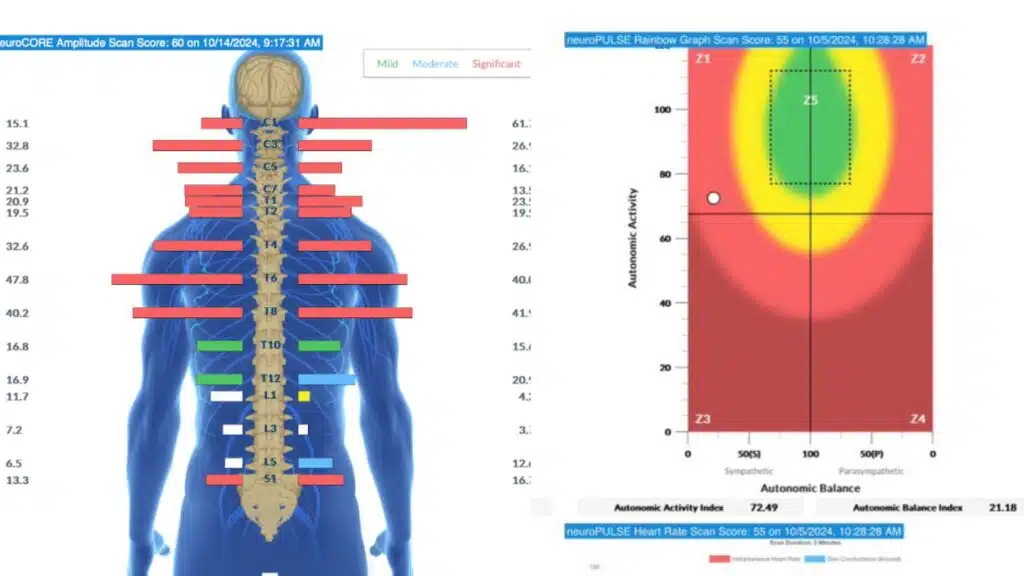 Sensory Seeking in Children: The Hidden Neurological Cause | PX Docs