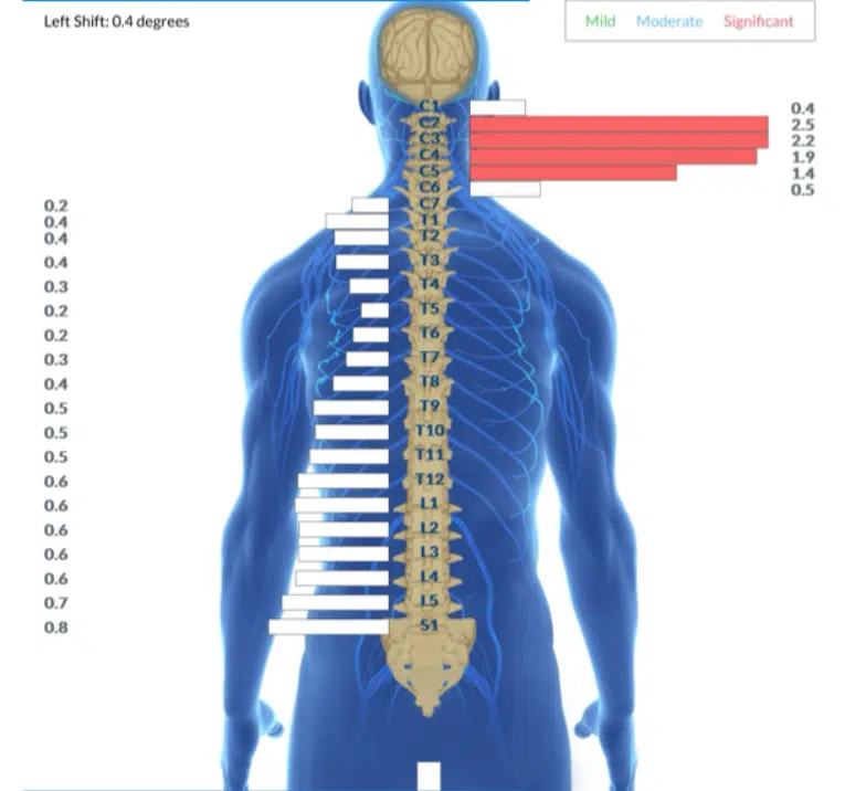 How Adjustments Help You Sleep: The Complete Guide to Better Rest | PX Docs