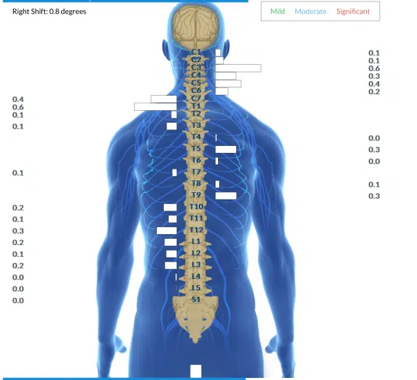 How Adjustments Help You Sleep: The Complete Guide to Better Rest | PX Docs