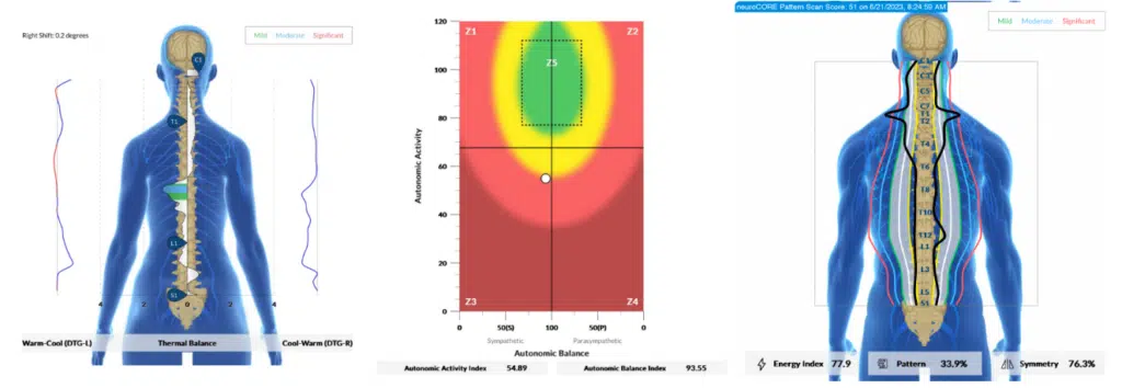 The Vagus Nerve and Autoimmune Connection | PX Docs