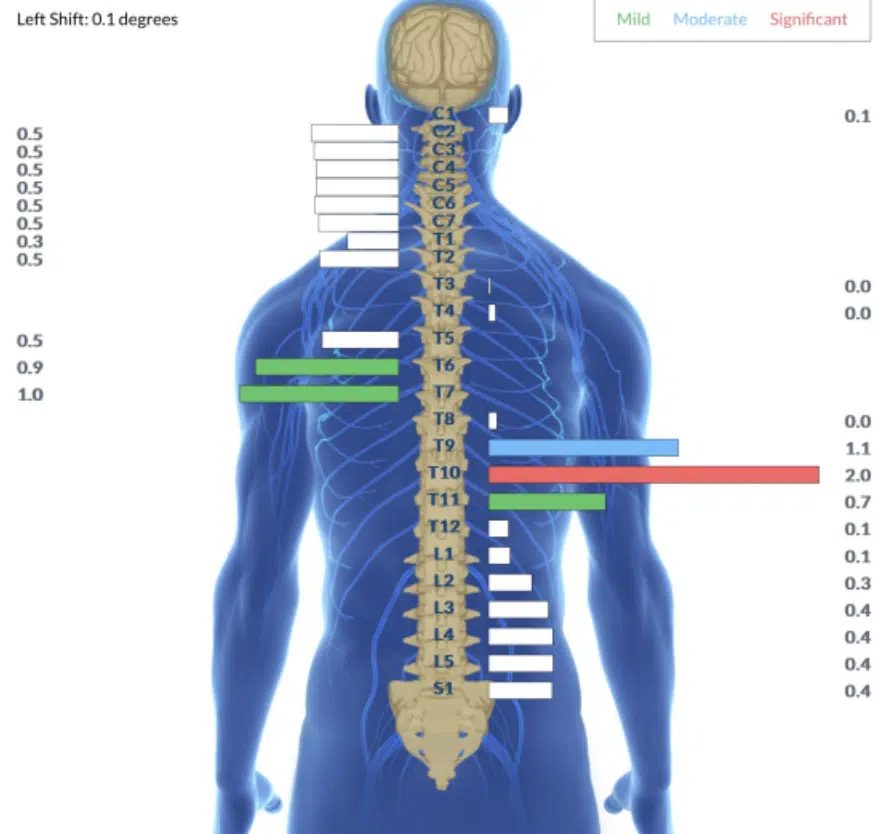 From Daily Anxiety and Missed School to Calm Mornings and Riding the Bus | PX Docs