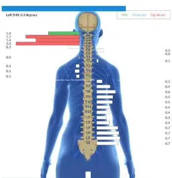 From Up to 80 Seizures a Day to Life-Changing Reduction with Minimal Impact | PX Docs