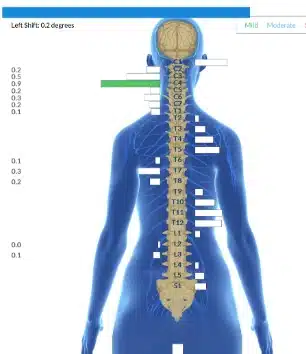 From Up to 80 Seizures a Day to Life-Changing Reduction with Minimal Impact | PX Docs