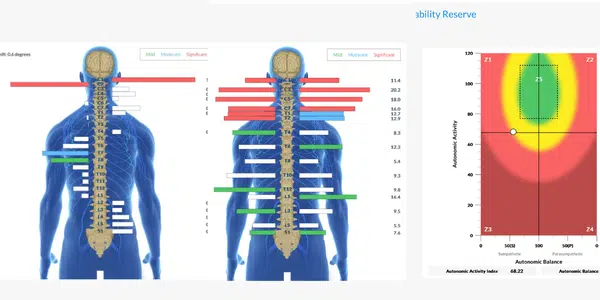 What Parents Need to Know About Profound Autism | PX Docs